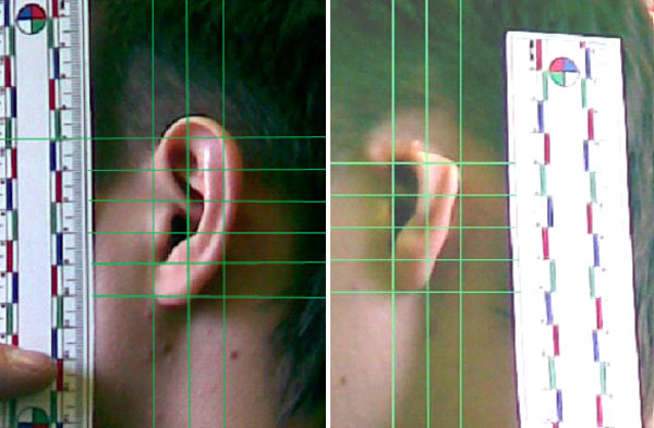 Фотоснимки ушных раковин с наложенными сетками.